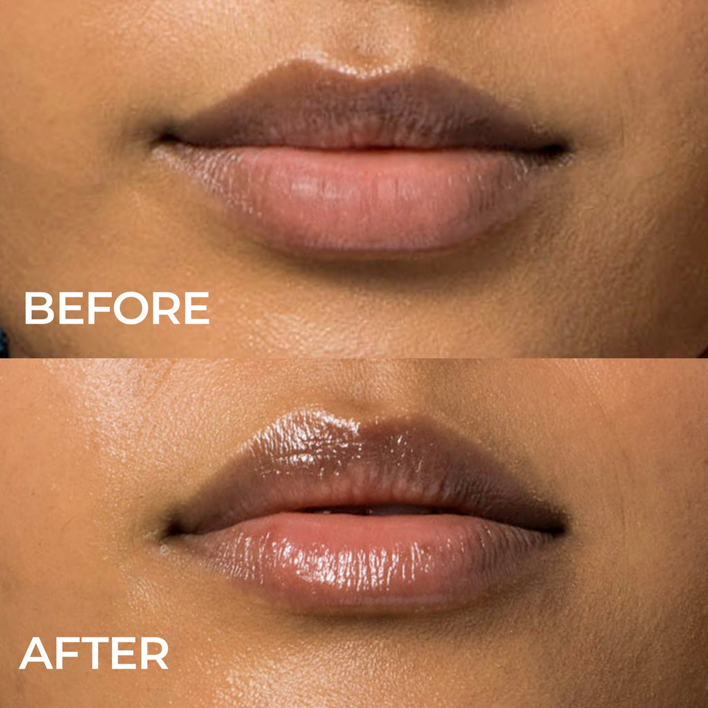Lip Remedy Mask